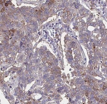 GPSM2 Antibody - BSA Free