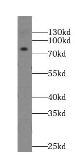 GPRIN3 Antibody - BSA Free