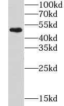 GPR17 Antibody - BSA Free