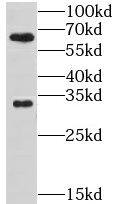 GPR162 Antibody - BSA Free
