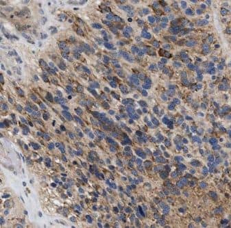 GPAA1 Antibody - BSA Free