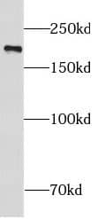 NUP210 Antibody - BSA Free