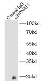 GNPNAT1 Antibody - BSA Free