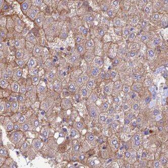 GNPNAT1 Antibody - BSA Free