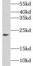 GNPNAT1 Antibody - BSA Free