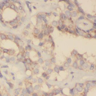 GNPDA2 Antibody - BSA Free