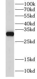 GNPDA2 Antibody - BSA Free