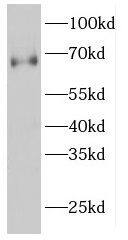 GNPAT Antibody - BSA Free