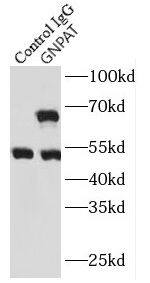 GNPAT Antibody - BSA Free