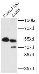 GNB5 Antibody - BSA Free