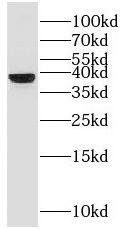 G protein beta 4 Antibody - BSA Free