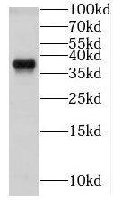 GNB1 Antibody - BSA Free