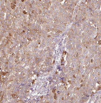 GLYATL1 Antibody - BSA Free