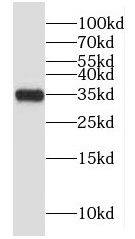 GLYATL1 Antibody - BSA Free