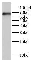 GLT25D2 Antibody - BSA Free