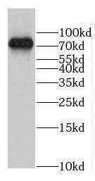 GLT25D1 Antibody - BSA Free