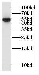 Glycine Receptor alpha 3 Antibody - BSA Free