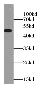 Glycine Receptor alpha 2 Antibody - BSA Free