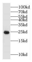 GLIPR1L1 Antibody - BSA Free