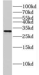 Connexin 31/GJB3 Antibody - BSA Free