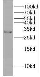 GIYD2 Antibody - BSA Free
