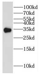 GIPC2 Antibody - BSA Free