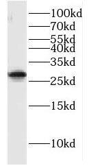 GIMAP2 Antibody - BSA Free