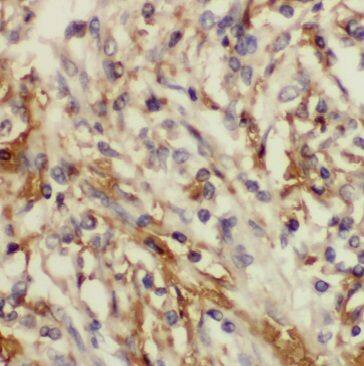 Gamma-Glutamyltransferase 7 Antibody - BSA Free