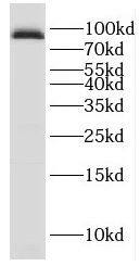 Gamma-Glutamyltransferase 7 Antibody - BSA Free