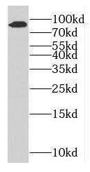 GFM2 Antibody - BSA Free