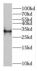 GEMIN8 Antibody - BSA Free