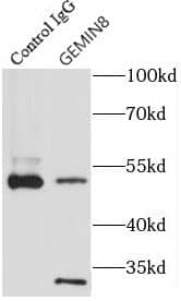 GEMIN8 Antibody - BSA Free