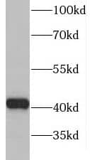 GDAP1L1 Antibody - BSA Free