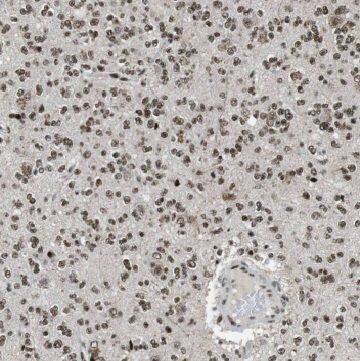 GDAP1L1 Antibody - BSA Free