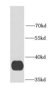 GDAP1 Antibody - BSA Free
