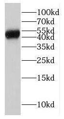 GCNT2 Antibody - BSA Free