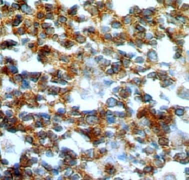 GCNT2 Antibody - BSA Free