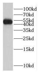 GCM2 Antibody - BSA Free