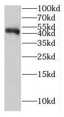 GCAT Antibody - BSA Free