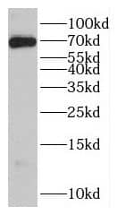 GBP6 Antibody - BSA Free
