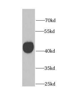 GATM Antibody - BSA Free