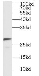 NOLA1 Antibody - BSA Free