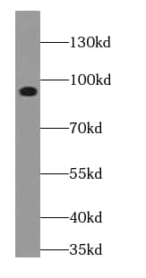 gamma Adducin Antibody - BSA Free