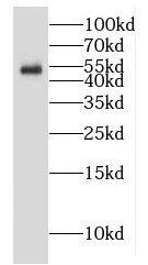 GALNTL5 Antibody - BSA Free