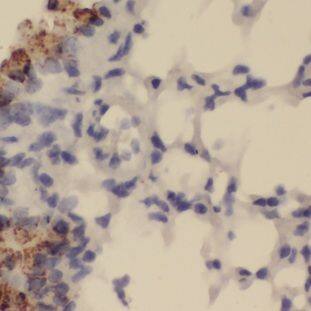 GALNTL5 Antibody - BSA Free