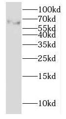 GALNTL2 Antibody - BSA Free