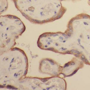 GALNTL2 Antibody - BSA Free