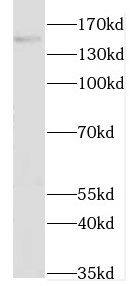 GAK Antibody - BSA Free