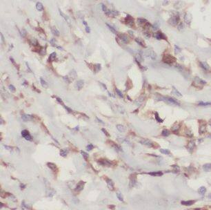 GAGE1 Antibody - BSA Free