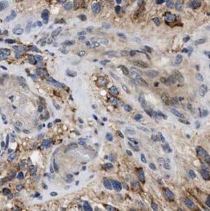 GABA-A R gamma 1 Antibody - BSA Free